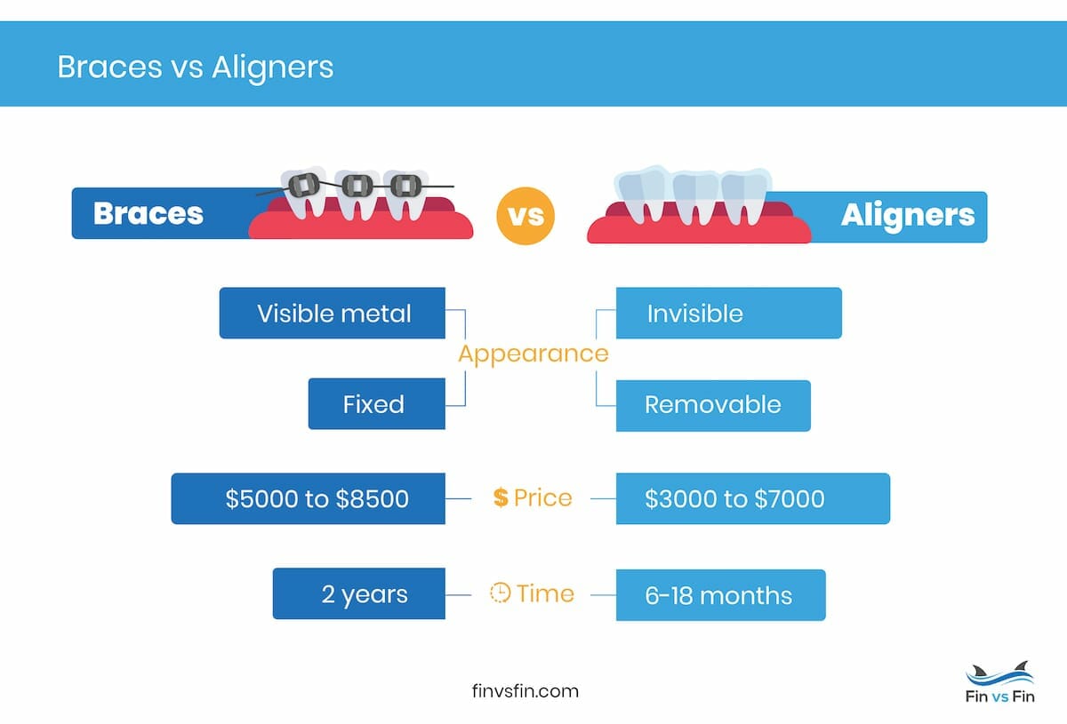clear aligners vs braces