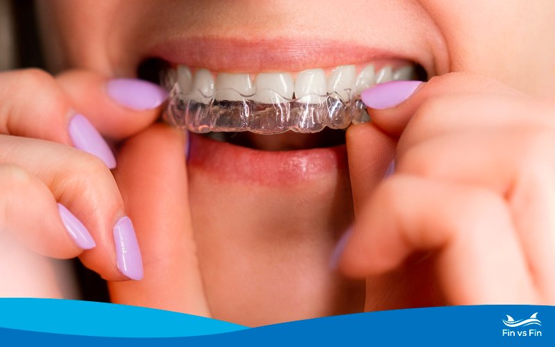 Byte vs AlignerCo: Which Low-Cost Aligners Are Best?