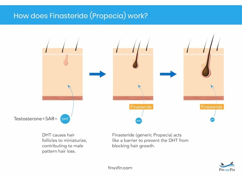 how finasteride gets results
