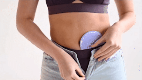 girl using Jovi menstrual cramp treatment