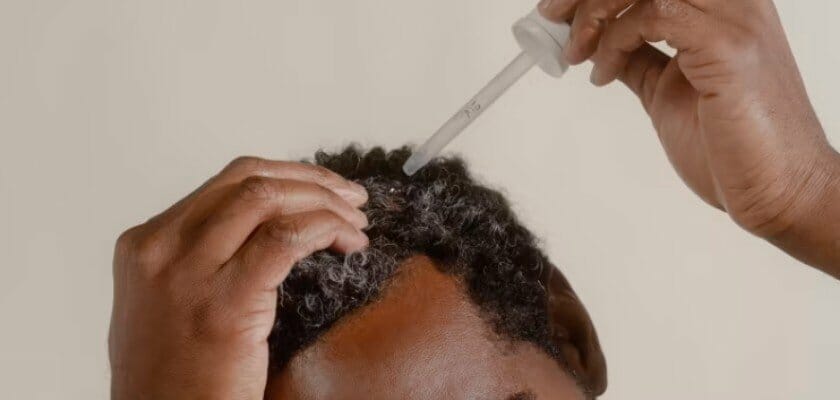 applying hair loss drops