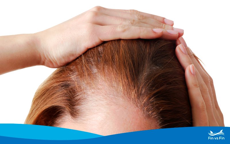 How Fast Does Hair Grow in a Month? (And How to Speed It Up!)