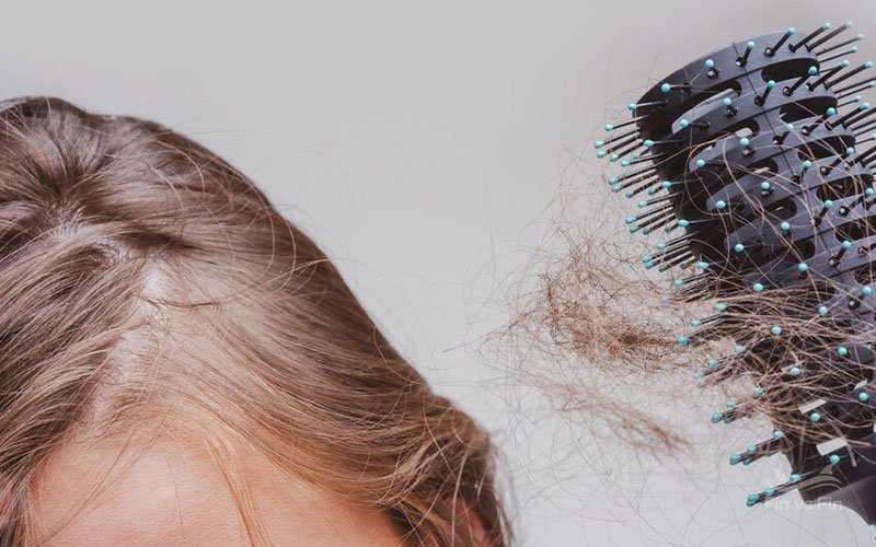 hair loss close up